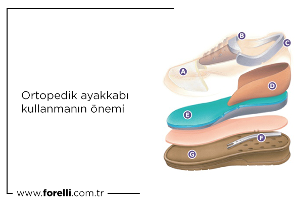 Ortopedik Ayakkabı Kullanmanın Önemi